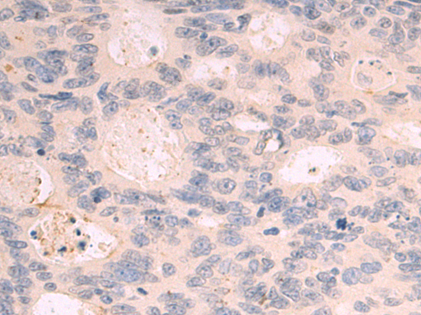 Rabbit Polyclonal Antibody to VEGFA