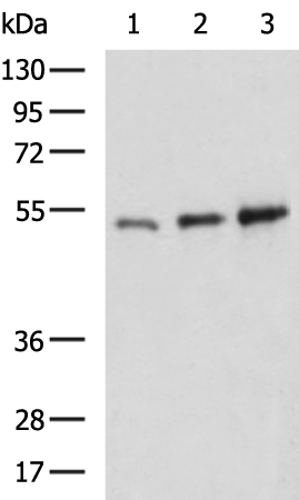 Rabbit Polyclonal Antibody to SARS-CoV-2 N