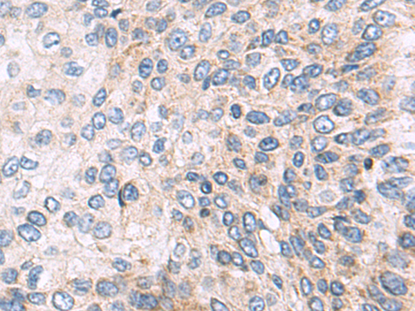 Rabbit Polyclonal Antibody to IFNB1