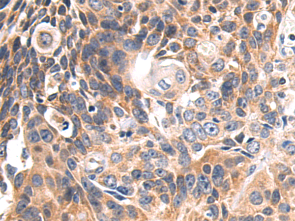 Rabbit Polyclonal Antibody to CSF1