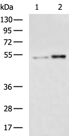 Rabbit Polyclonal Antibody to TUBA1B