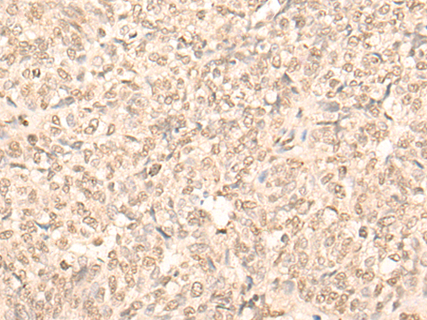 Rabbit Polyclonal Antibody to MLLT6
