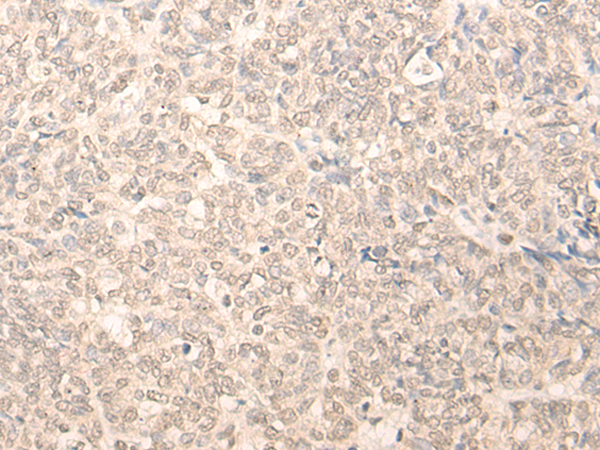 Rabbit Polyclonal Antibody to RUVBL2