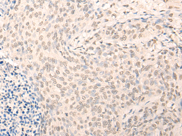 Rabbit Polyclonal Antibody to RIOX2