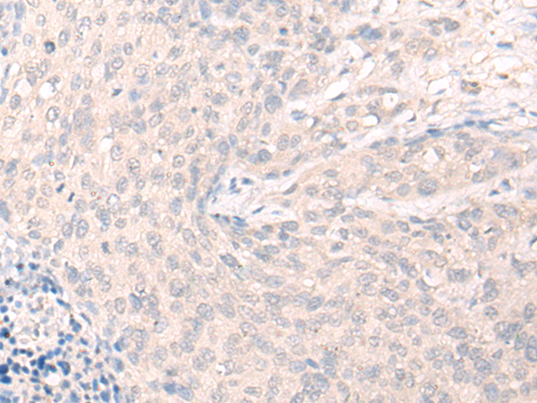 Rabbit Polyclonal Antibody to LILRA2