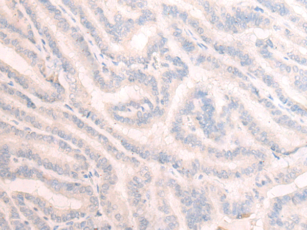 Rabbit Polyclonal Antibody to TBC1D2