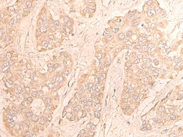 Rabbit Polyclonal Antibody to CDK18
