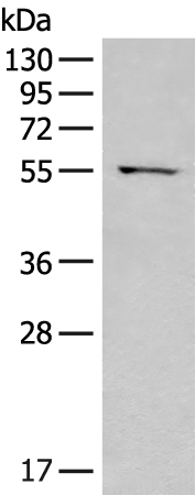 Rabbit Polyclonal Antibody to SELENBP1