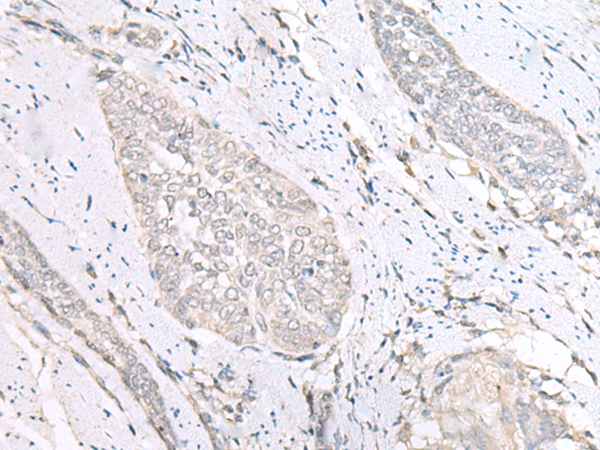 Rabbit Polyclonal Antibody to GPBP1L1