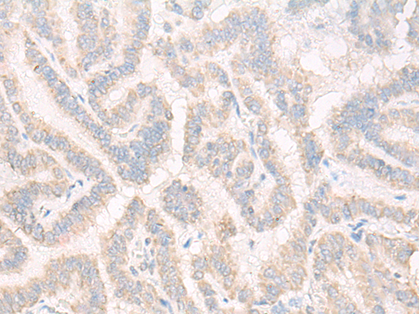Rabbit Polyclonal Antibody to BPIFB1