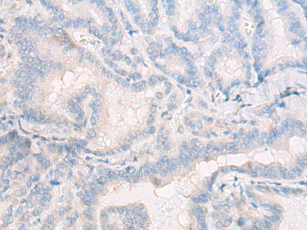 Rabbit Polyclonal Antibody to IFIT3