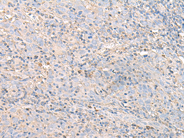 Rabbit Polyclonal Antibody to IGHA1