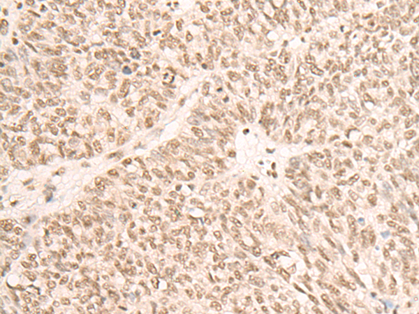 Rabbit Polyclonal Antibody to SF3A3