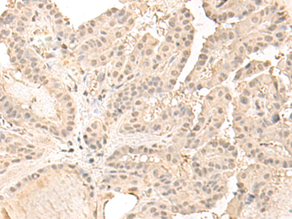 Rabbit Polyclonal Antibody to ZGPAT