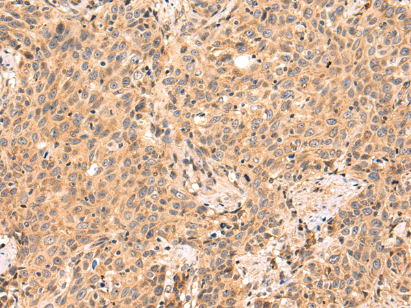 Rabbit Polyclonal Antibody to THUMPD3