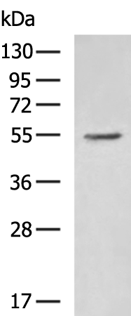 Rabbit Polyclonal Antibody to HBP1