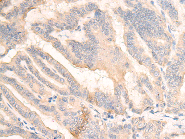 Rabbit Polyclonal Antibody to M1AP