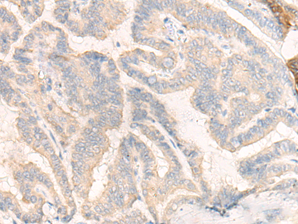 Rabbit Polyclonal Antibody to COG4