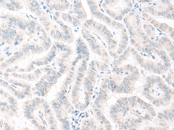 Rabbit Polyclonal Antibody to NCLN