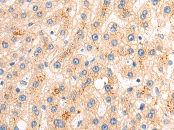Rabbit Polyclonal Antibody to ATP5F1A