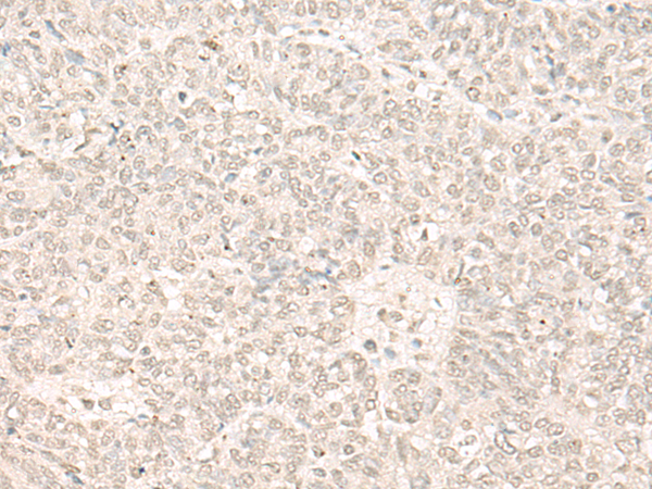 Rabbit Polyclonal Antibody to FTSJ3