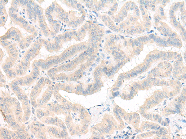 Rabbit Polyclonal Antibody to AOAH