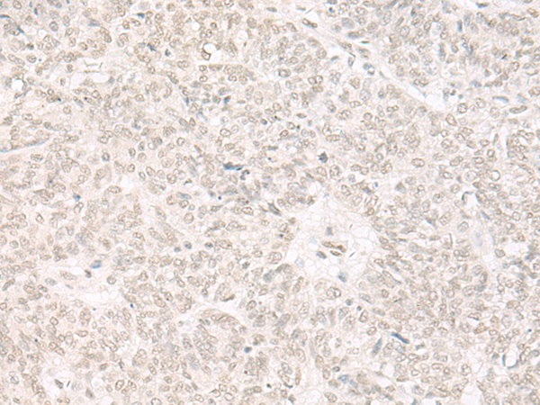 Rabbit Polyclonal Antibody to KAT14