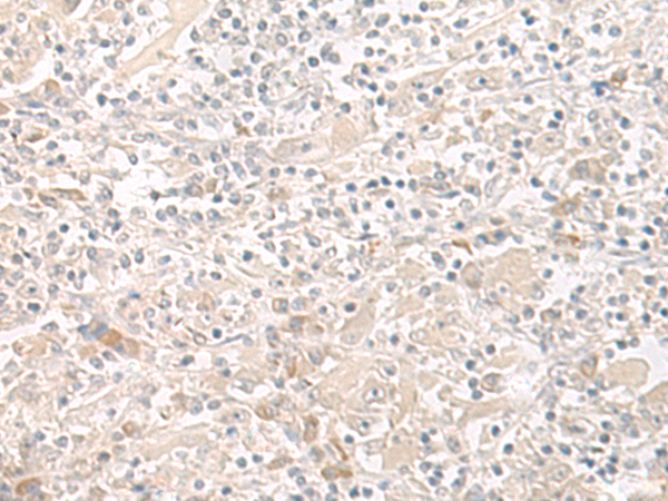 Rabbit Polyclonal Antibody to THADA