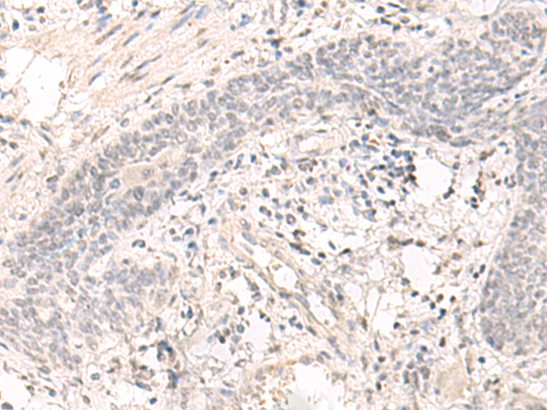 Rabbit Polyclonal Antibody to SAP130