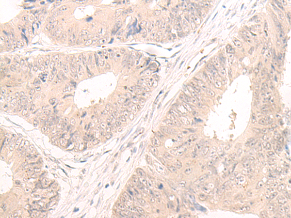 Rabbit Polyclonal Antibody to LCMT2