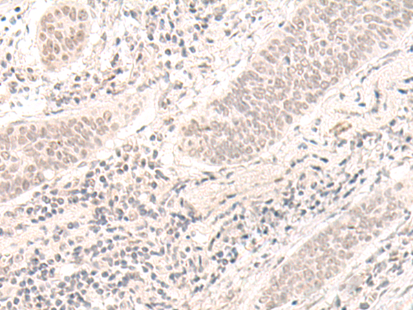 Rabbit Polyclonal Antibody to ZBED1