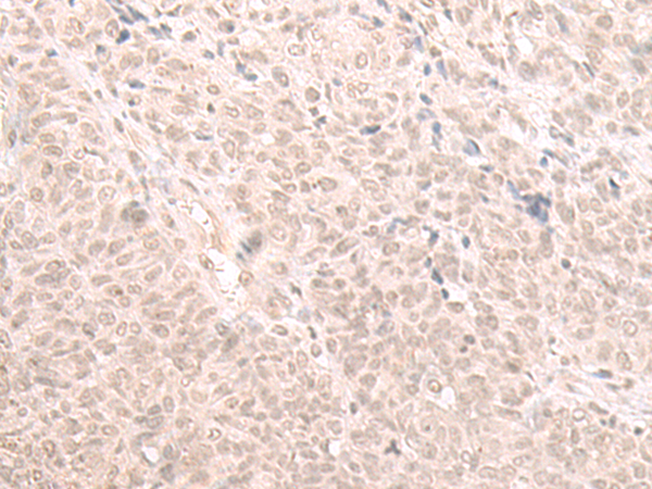 Rabbit Polyclonal Antibody to HOOK2