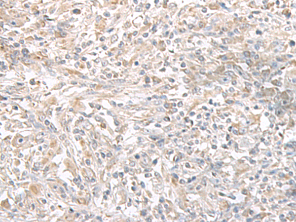 Rabbit Polyclonal Antibody to PFKM