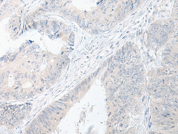 Rabbit Polyclonal Antibody to GPRASP2