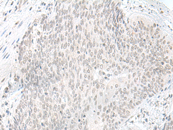 Rabbit Polyclonal Antibody to ORC1
