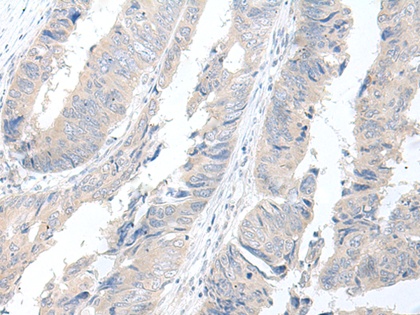 Rabbit Polyclonal Antibody to GBA2