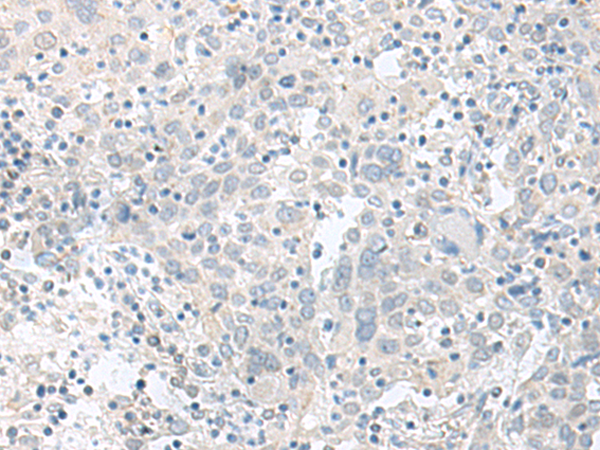 Rabbit Polyclonal Antibody to TIMM8A