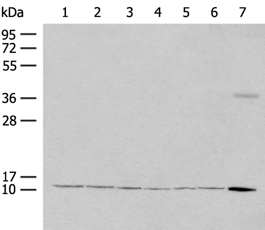 Rabbit Polyclonal Antibody to RPS27L