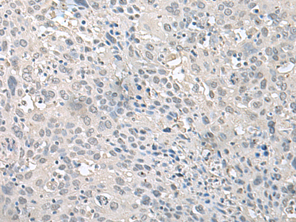 Rabbit Polyclonal Antibody to EPM2A