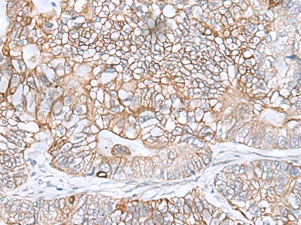 Rabbit Polyclonal Antibody to C9orf116