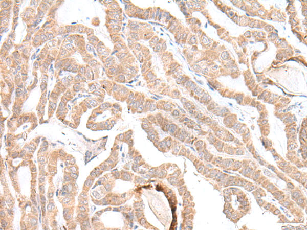 Rabbit Polyclonal Antibody to PLGLB2