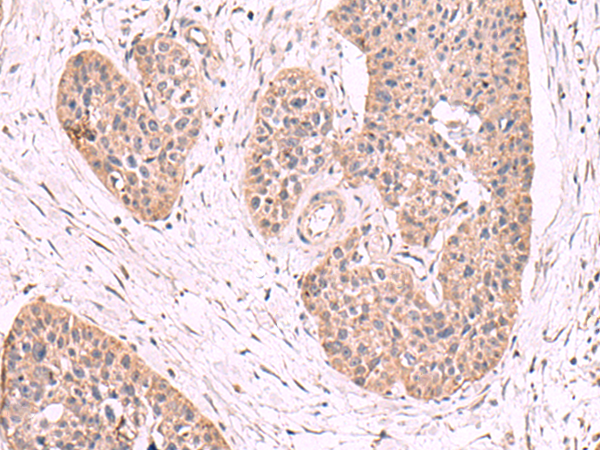 Rabbit Polyclonal Antibody to MGP