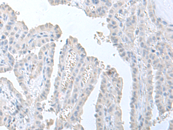 Rabbit Polyclonal Antibody to STAU2