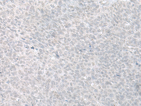 Rabbit Polyclonal Antibody to TCIM