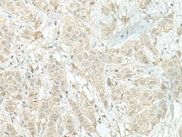 Rabbit Polyclonal Antibody to MIEN1