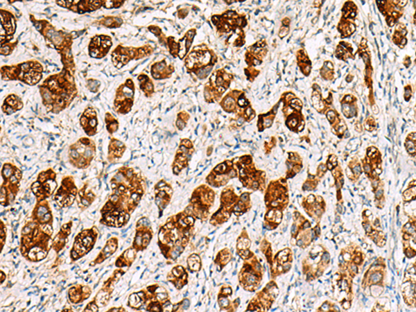 Rabbit Polyclonal Antibody to SAA1