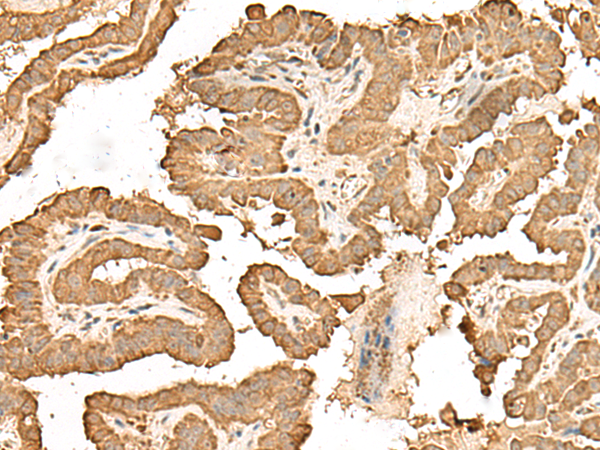Rabbit Polyclonal Antibody to RPS25