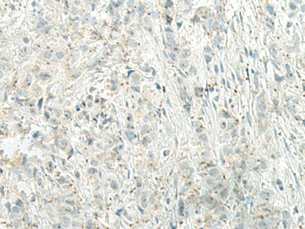 Rabbit Polyclonal Antibody to UQCC2