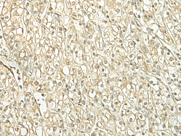 Rabbit Polyclonal Antibody to SPIRE1