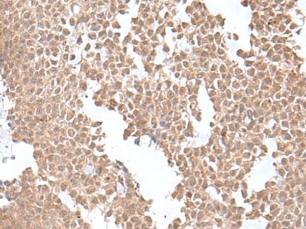 Rabbit Polyclonal Antibody to SNRNP25